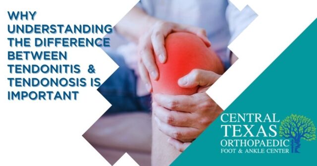 Blog Archives Central Texas Orthopaedic Foot And Ankle Center